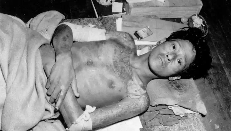 80 Yıl Sonra Nagasaki’den Korkutan Uyarı: Nükleer Felaket Pusuda!