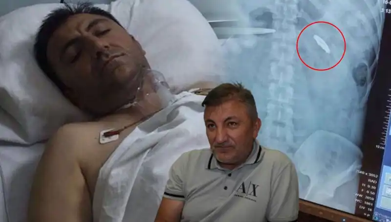 15 Temmuz'un İzleri: Vücudunda Kurşunla Yaşayan Kahramanların Hikayesi